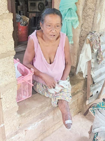 දෙපා අහිමිව සිටින මව